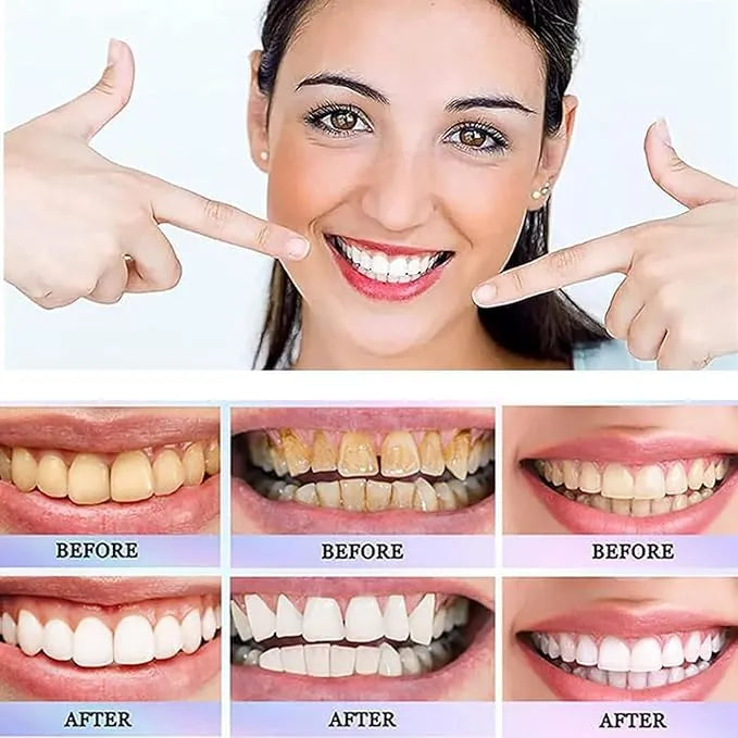 Oralhoe - Nicotinamide Dazzle White Toothpaste