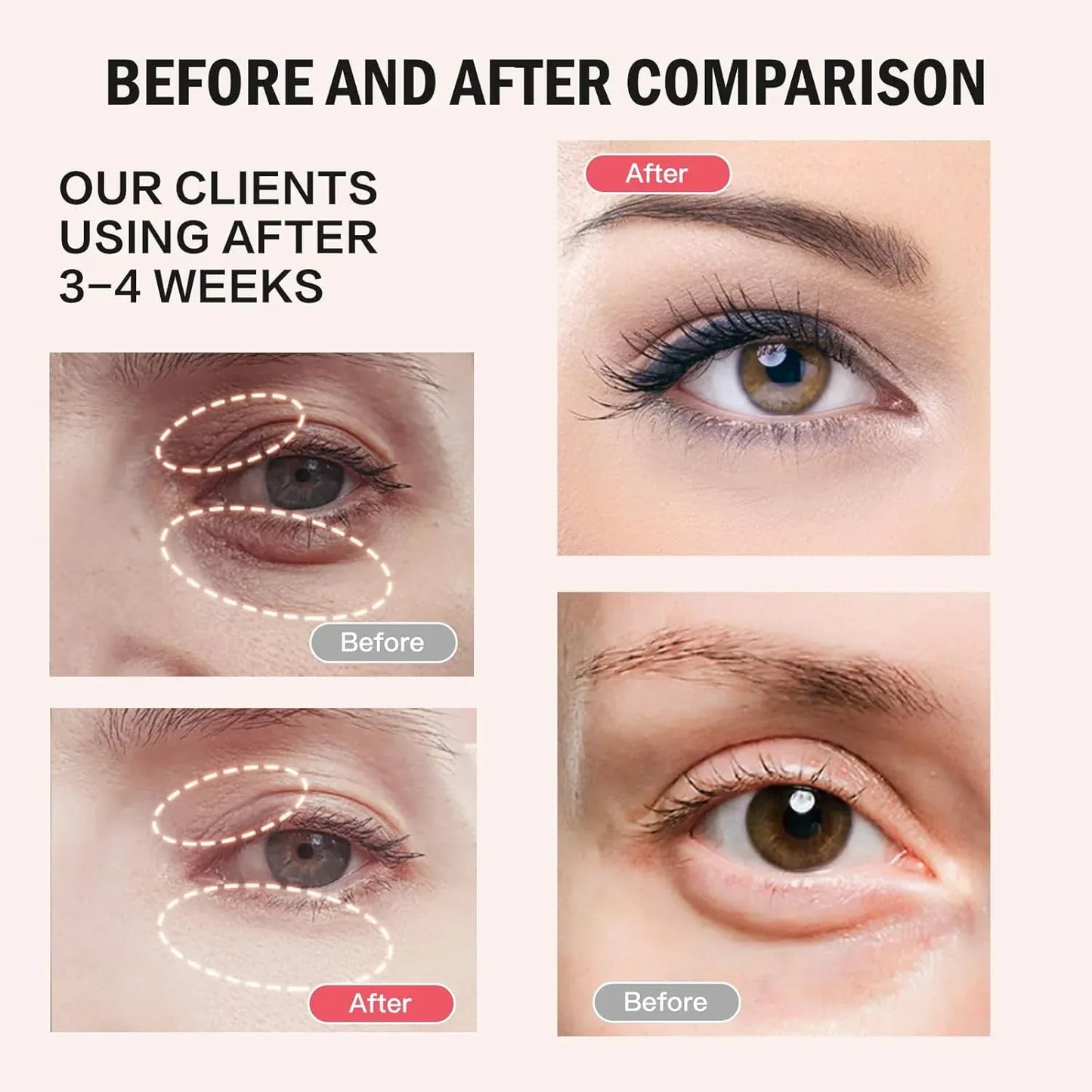 Retinol Eye Stick Balm
